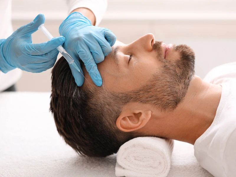 exosome therapy for hair loss league city tx