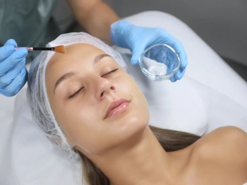 medical grade chemical peels in league city tx