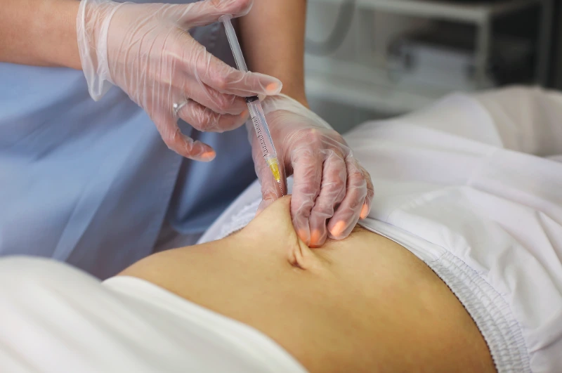 PCDC fat dissolving injections areas