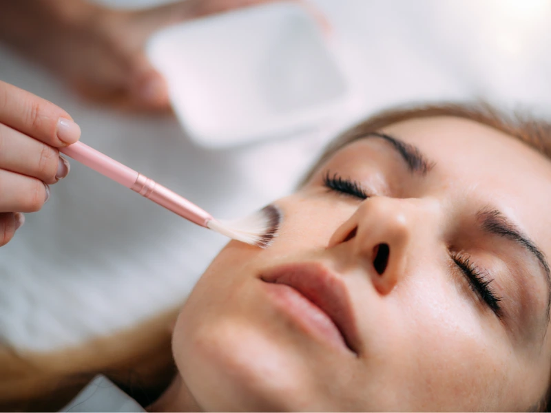 chemical peel for hyperpigmentation