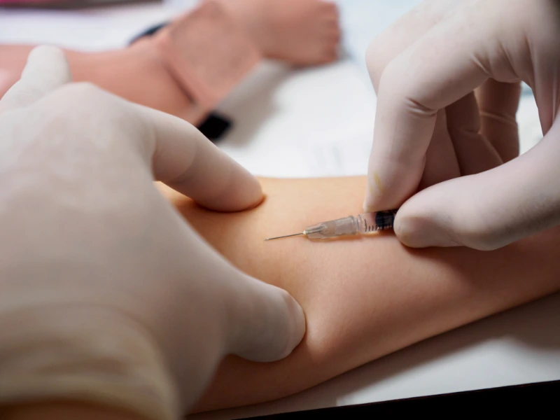 pcdc lipolysis