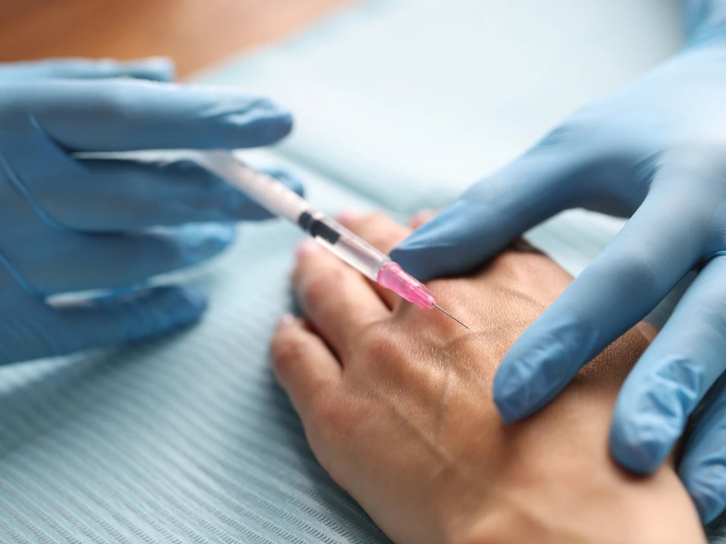 Sclerotherapy Cost