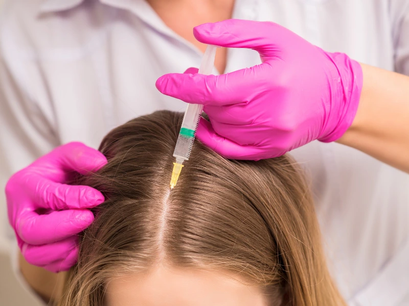 exosomes for hair loss reviews​