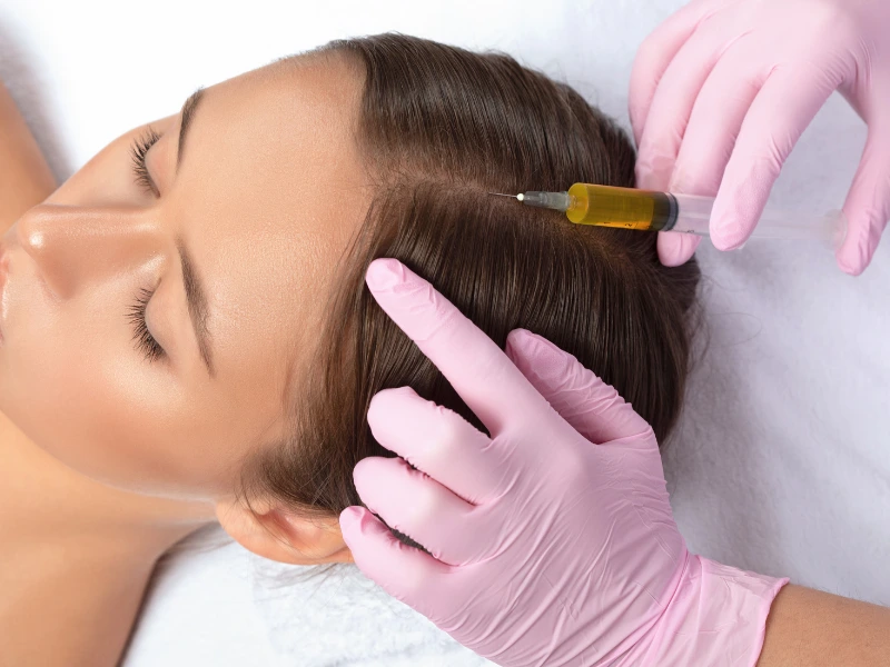 prp hair restoration before and after