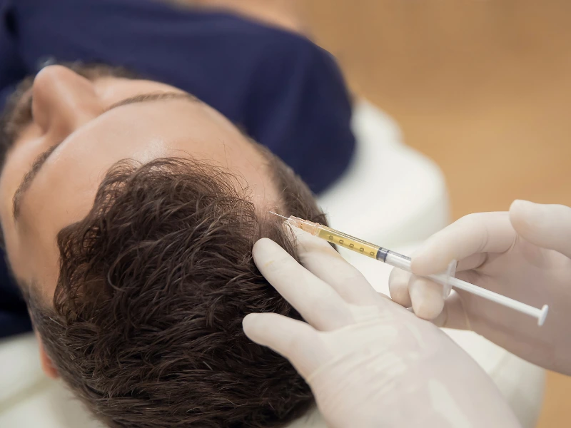 prp hair restoration in league citc tx