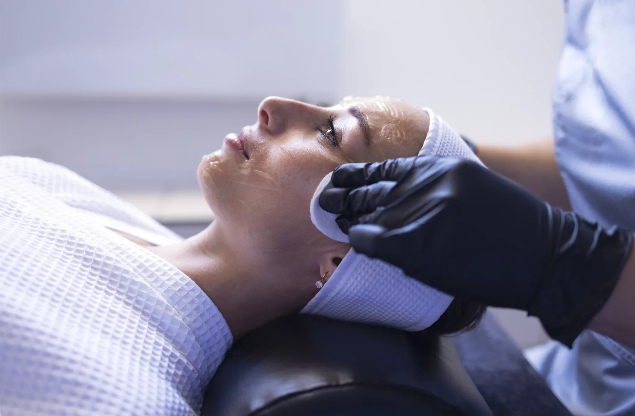 process of skin whitening and bleaching